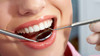 دهان و دندان